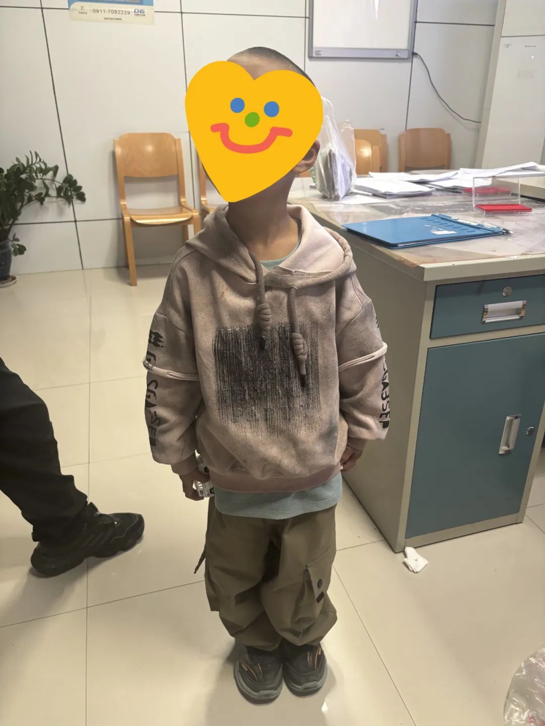 【延安首例】我院小兒外科完成腹腔鏡下巨結腸切除術